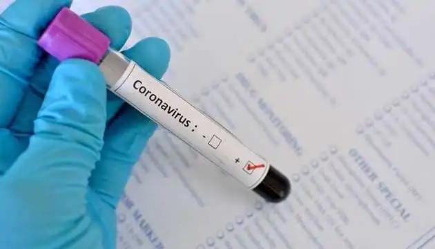 На Кіровоградщині зареєстрували 17 нових випадків COVID-19