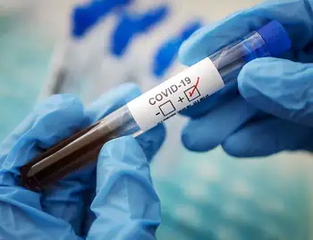 На Кіровоградщині за добу коронавірус виявили у 97 людей фото 1