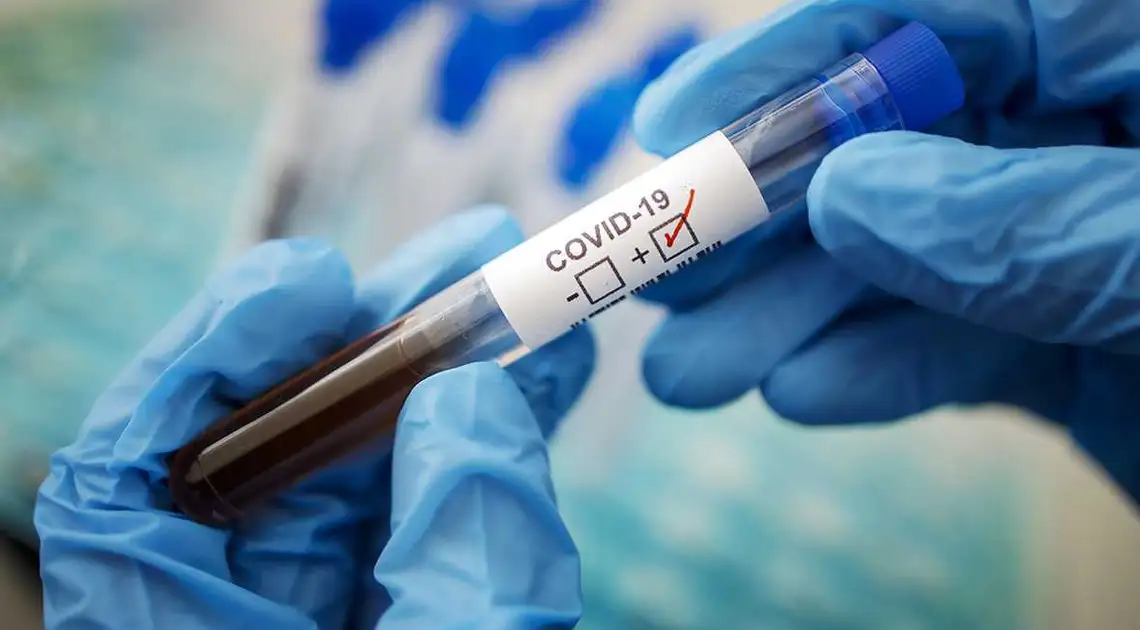 На Кіровоградщині за добу коронавірус виявили у 97 людей фото 1