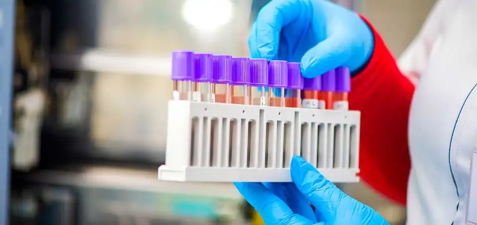 На Кіровоградщині в 199 людей підтвердили коронавірус, троє померли