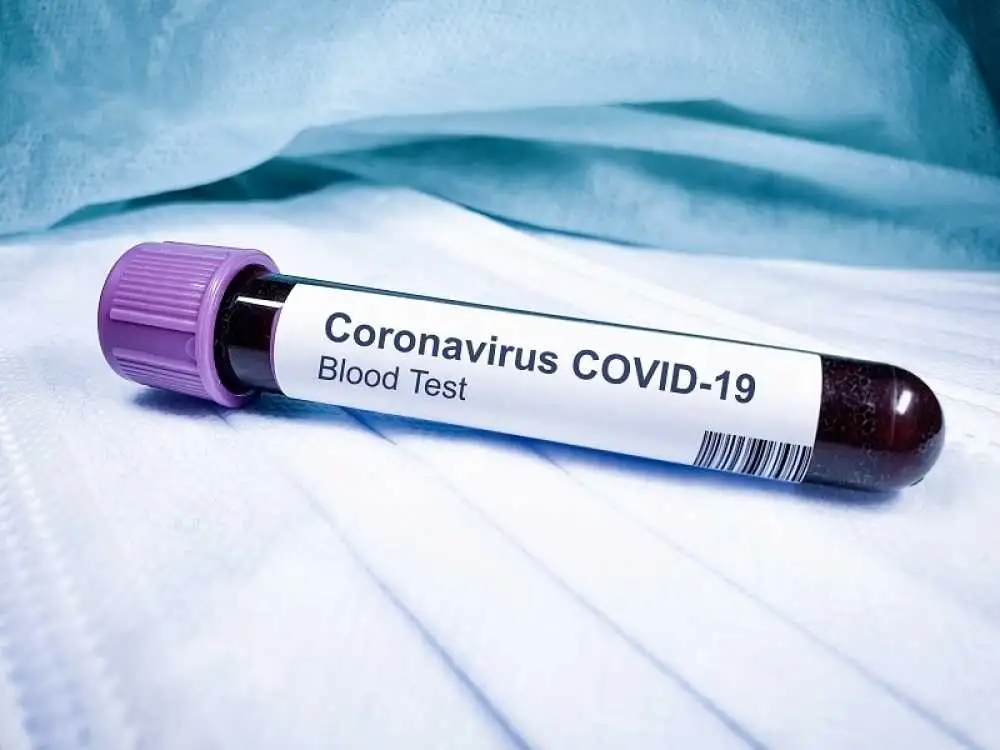За добу в Україні на COVID-19 захворіло понад 4 тисячі людей фото 1