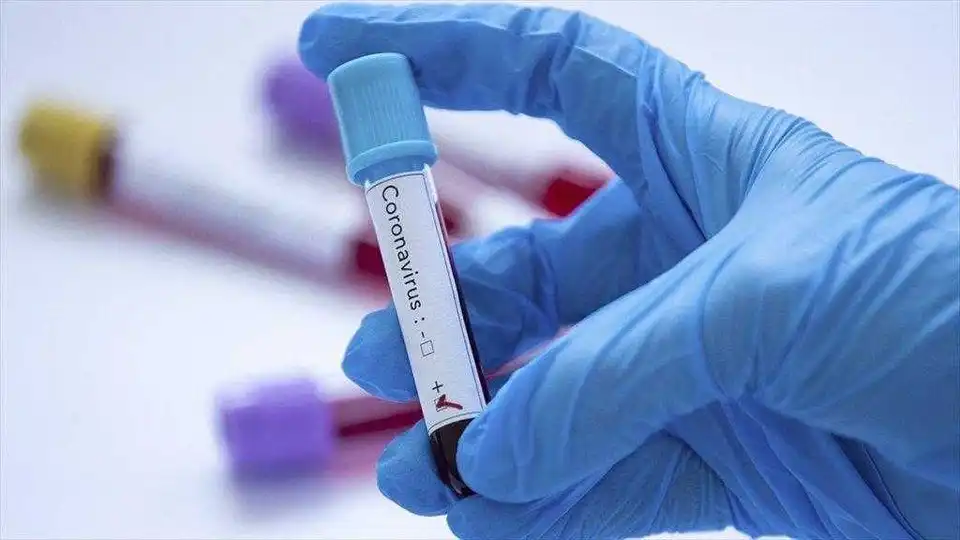 В Україні зафіксували 804 випадки COVID-19, з них 20 летальних
