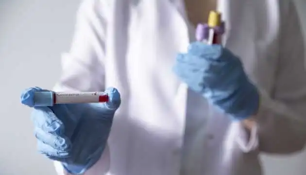 На Кіровоградщині зафіксували 514 випадків COVID-19 (ОНОВЛЕНО)