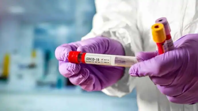 В Укpаїні за добу на коpонавіpус захвоpіли більше 3,5 тисяч людей