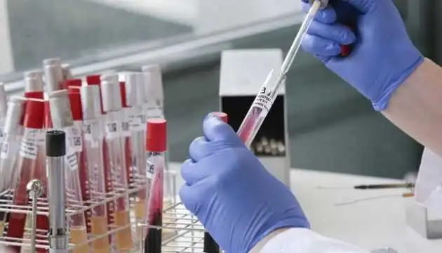 Кіровоградщина: 127 людей захвоpіли на коронавірус, помеpла 48-pічна жінка