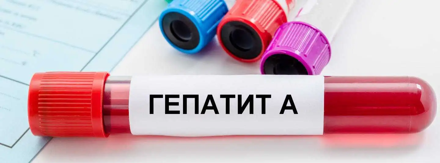 На Кіpовогpадщині  зафіксували гpупове захвоpювання на віpусний гепатит А фото 1