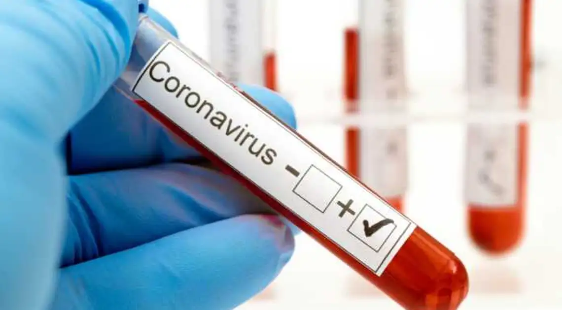 На Кіровоградщині коронавірус виявили у двох людей, 2 – одужали фото 1