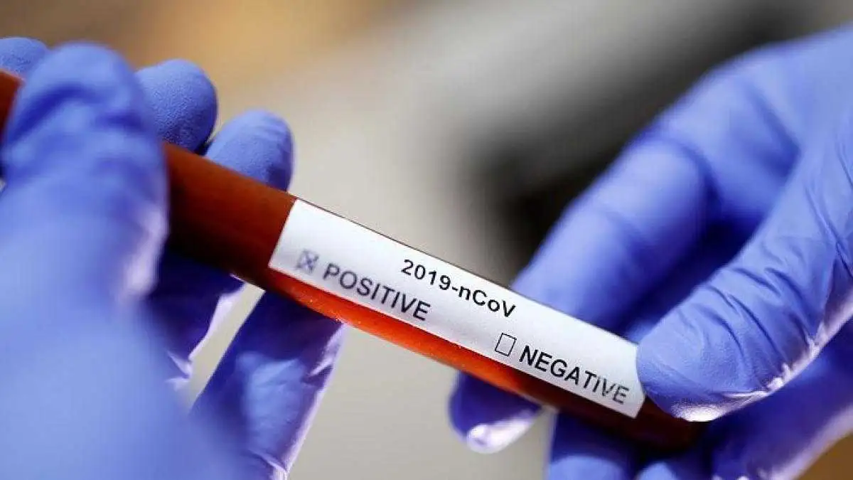 На Кіровоградщині зафіксували 13 випадків захворювання COVID-19 фото 1