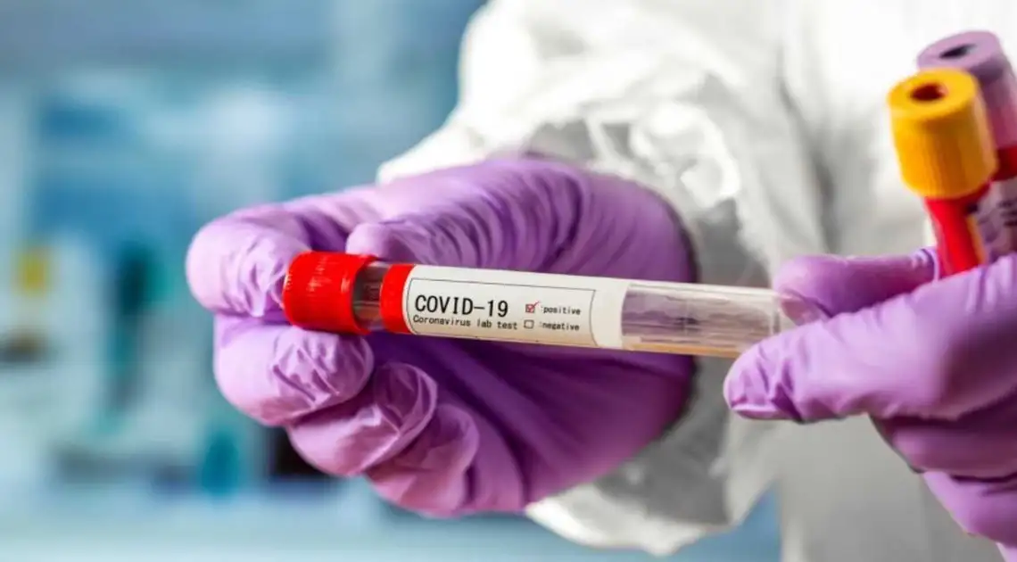 На Кіровоградщині на коронавірус захворіли 34 людини, троє хворих померли фото 1