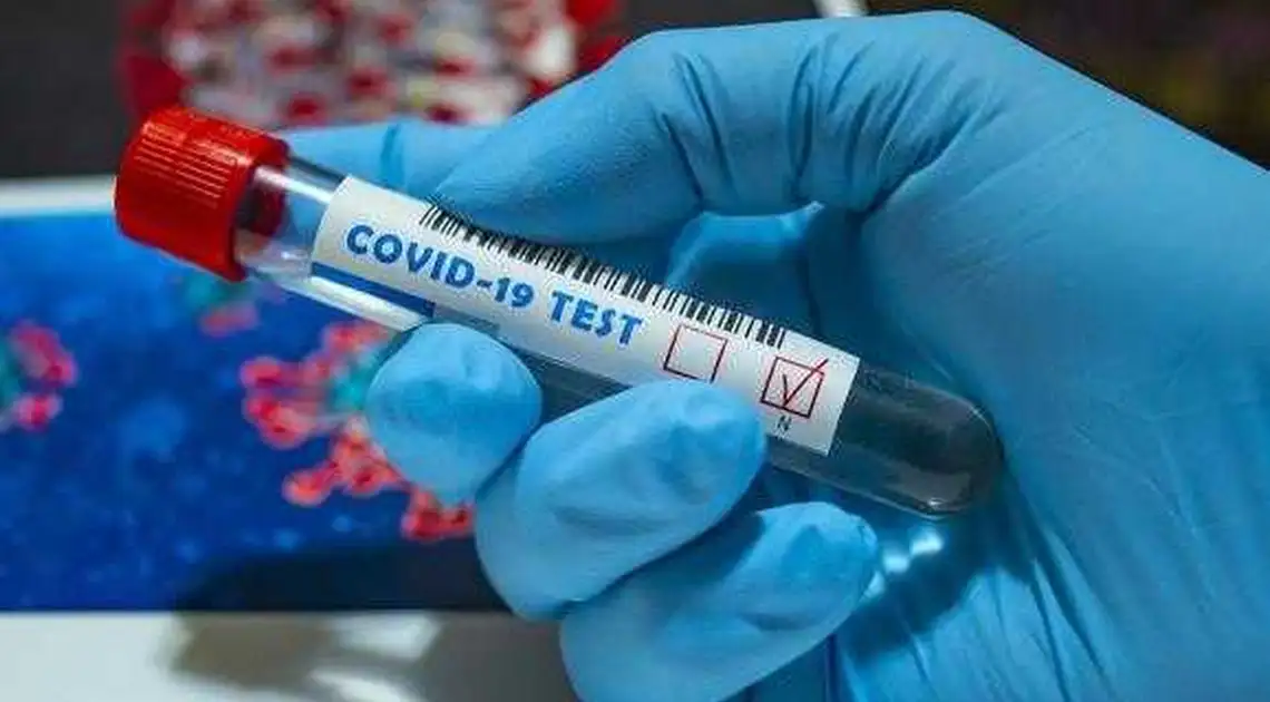 На Кіровоградщині зареєстрували ще 114 випадків коронавірусу, двоє людей померли фото 1