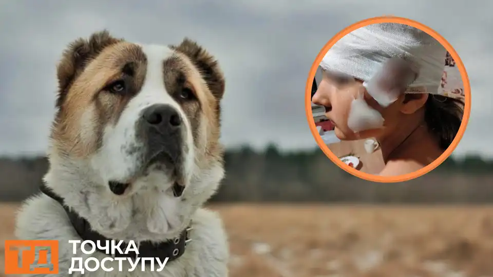 алабай напав на дівчинку на Кіровоградщині