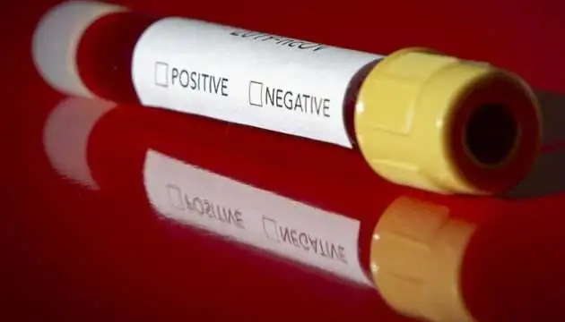В Україні за добу зафіксували рекордні 4 633 нові випадки захворювання на COVID-19 фото 1