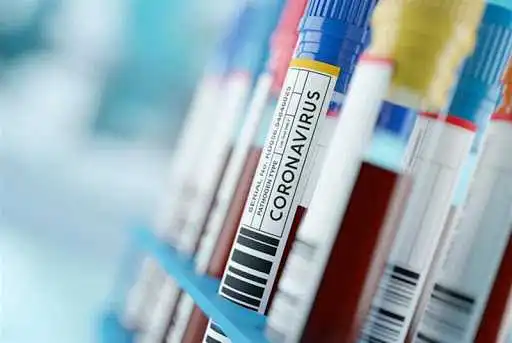 На Кіровоградщині 43 людини захворіли на коронавірус, четверо пацієнтів померли