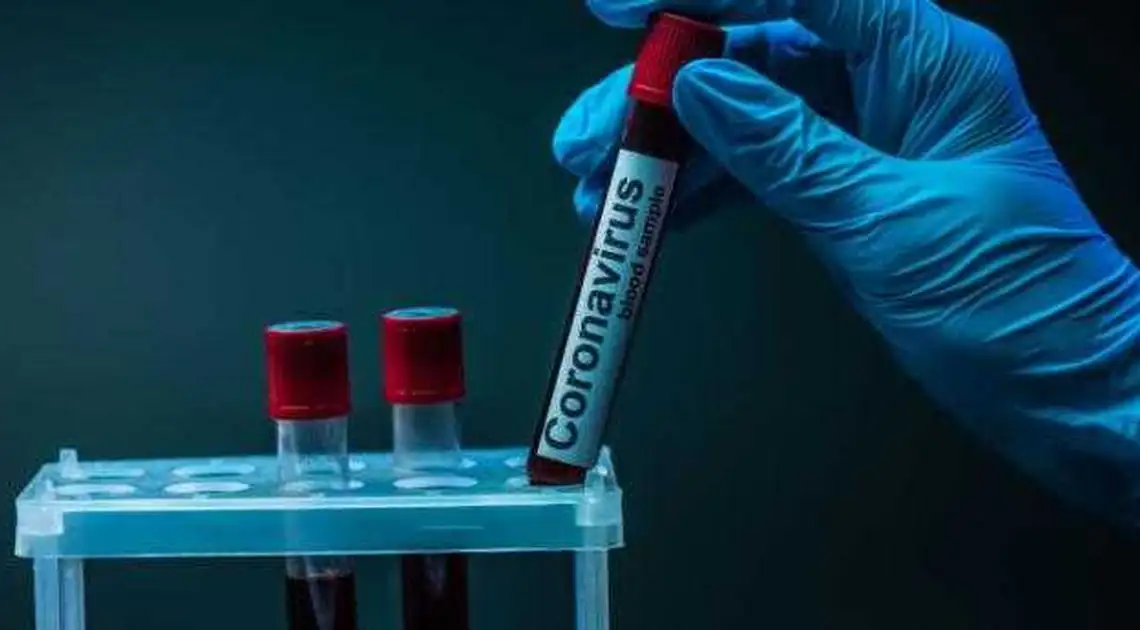 Кіровоградщина: за добу зафіксували 168 нових випадків коронавiрусу, семеро людей померли фото 1