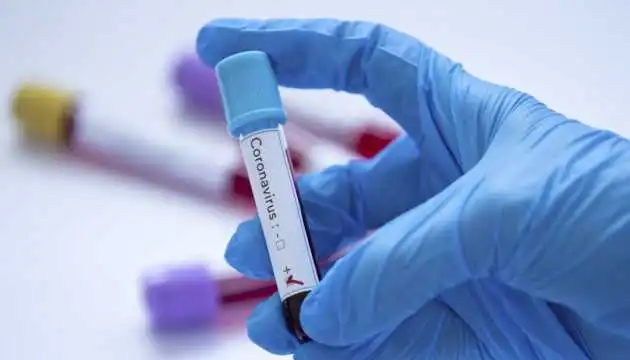 В Україні зареєстрували 3 виробники тест-систем для діагностики коронавірусу - МОЗ