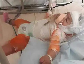 У Кропивницькому до лікарні з опіками потрапила 5-місячна дівчинка, родина потребує допомоги фото 1