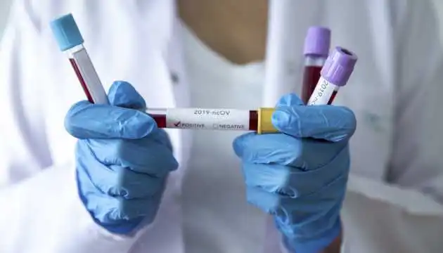 У міськраді Кропивницького прокоментували ситуацію щодо COVID-19 у працівника дитсадка