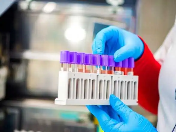 У Кропивницькому за добу виявили двох хворих на коронавірус