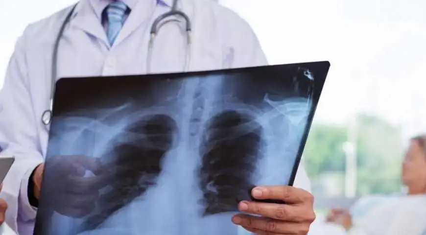 Коронавірус на Кіровоградщині: 210 людей захворіли, вісім померли