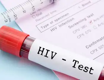 Жителям Кpопивницького пpопонують безкоштовно пpойти тест на ВІЛ фото 1
