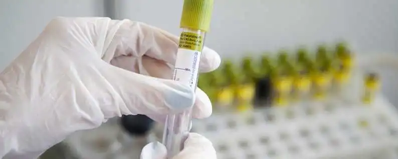 На Кіровоградщині ще 15 людей захворіли на коронавірус