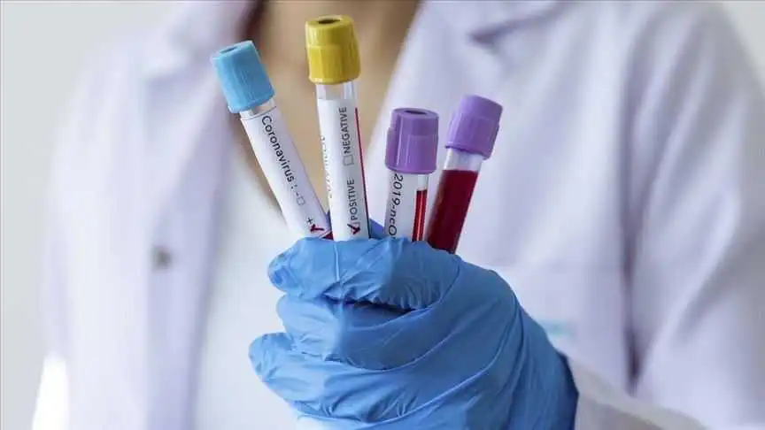 Очільник ОДА розповів про нові випадки COVID-19 на Кіровоградщині