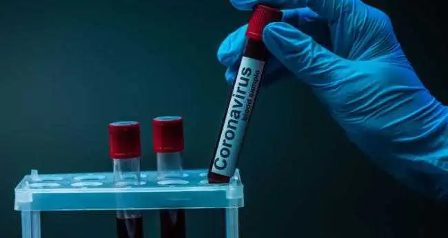 Кіровоградщина: на коронавірус захворіли 326 людей, двоє померли від ускладнень фото 1