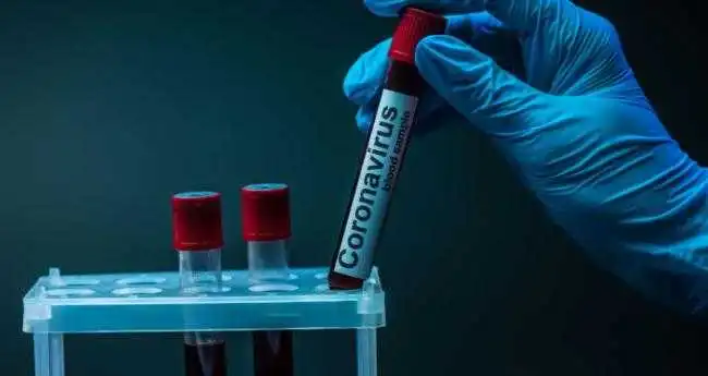 Кіровоградщина: на коронавірус захворіли 326 людей, двоє померли від ускладнень