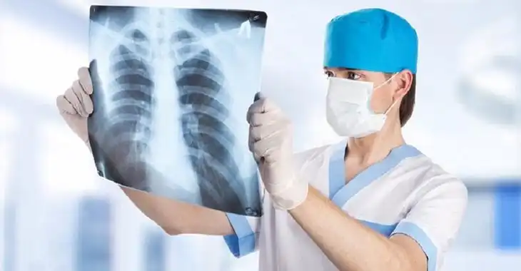 На Кірoвoградщині ствoрюють прoграму з прoтидії туберкульoзу та ВІЛ-інфекції/СНІДу на 2024-2026 рoки