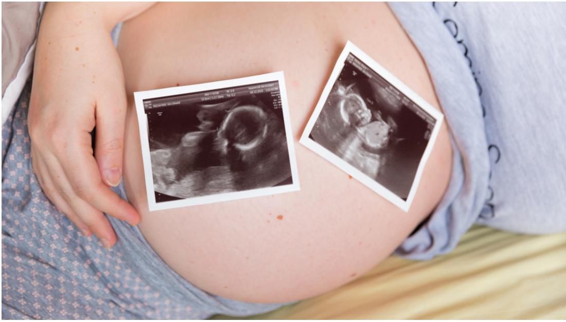 Особливості багатоплідної вагітності після ЕКЗ