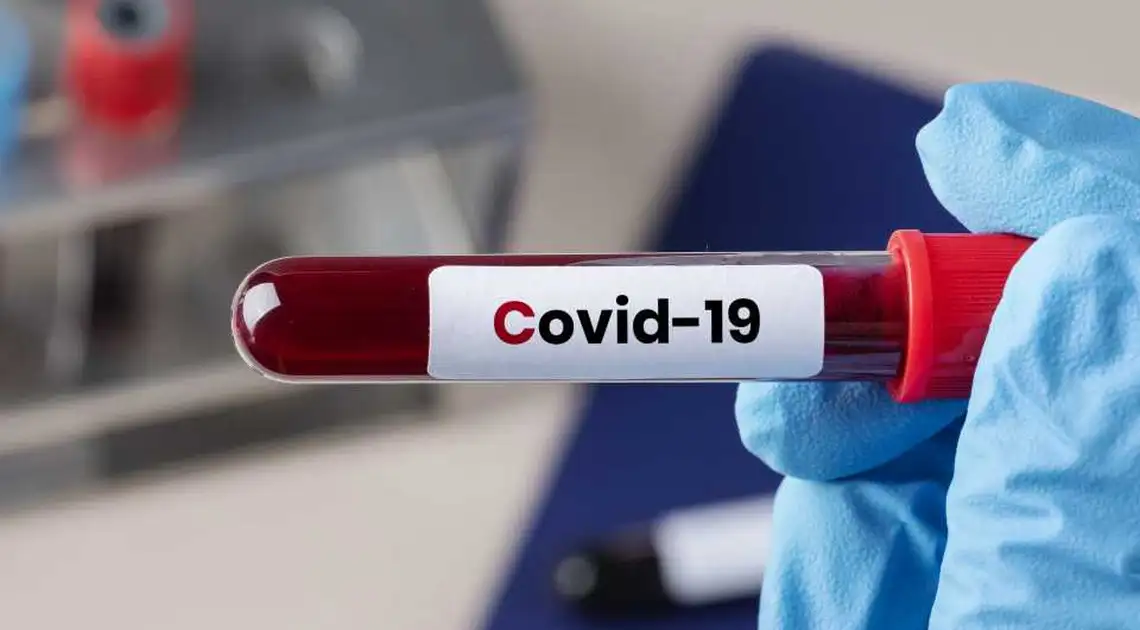 Кіровоградщина: понад 120 людей захворіли на коронавірус, 14 померли від ускладнень фото 1